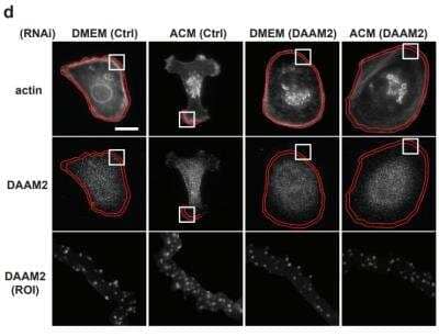 Immunocytochemistry/Immunofluorescence: DAAM2 Antibody [NBP2-47496] - ACM containing Wnt11-positive exosomes control CEP192, AURKB and PLK4 through DVL2. Model for DVL2 regulating recruitment of CEP192, AURKB and PLK4 to cell cortex in response to ACM stimulation.  Image collected and cropped by CiteAb from the following publication (//static-content.springer.com/esm/art%3A10.1038%2Fs41467-019-10241-w/MediaObjects/41467_2019_10241_MOESM1_ESM.pdf), licensed under a CC-BY license.