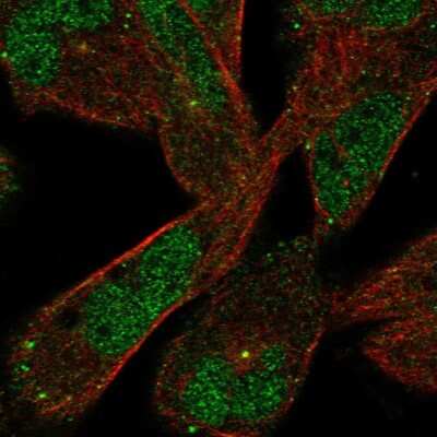 Immunocytochemistry/ Immunofluorescence DAAM2 Antibody - BSA Free