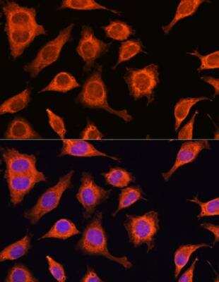 Immunocytochemistry/Immunofluorescence: DAAM2 Antibody [NBP2-92809] - Analysis of L929 cells using DAAM2 Rabbit pAb at dilution of 1:100. Blue: DAPI for nuclear staining.
