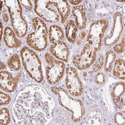 Immunohistochemistry-Paraffin: DAAM2 Antibody [NBP2-49141] - Staining of human kidney shows strong cytoplasmic positivity in renal tubules.