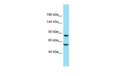 Western Blot: DAAM2 Antibody [NBP2-87243] - Host: Rabbit. Target Name: Daam2. Sample Type: Mouse Heart lysates. Antibody Dilution: 1.0ug/ml