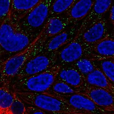 Immunocytochemistry/Immunofluorescence: DAB1 Antibody [NBP2-57001] - Staining of human cell line RT4 shows localization to vesicles.