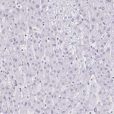 Immunohistochemistry-Paraffin: DAB1 Antibody [NBP2-38661] - Staining of human liver shows no positivity in hepatocytes as expected.