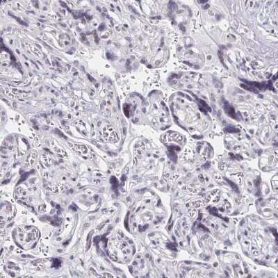 Immunohistochemistry-Paraffin: DAB1 Antibody [NBP2-38661] - Staining of human placenta shows no positivity in trophoblastic cells as expected.