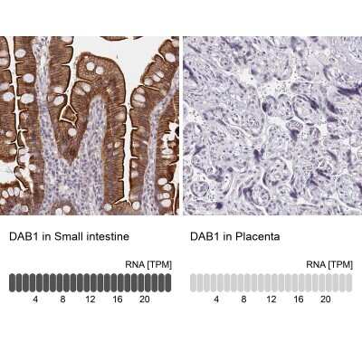 Immunohistochemistry-Paraffin: DAB1 Antibody [NBP2-38661] - Analysis in human small intestine and placenta tissues using NBP2-38661 antibody. Corresponding DAB1 RNA-seq data are presented for the same tissues.