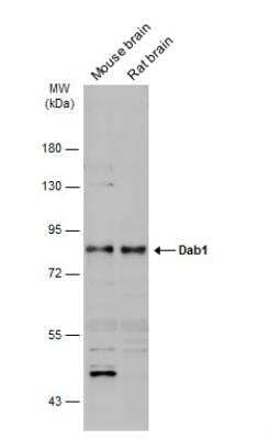 Western Blot: DAB1 Antibody [NBP2-16095] - Various tissue extracts (50 ug) were separated by 7.5% SDS-PAGE, and the membrane was blotted with Dab1 antibody [N1N3] diluted at 1:1000. The HRP-conjugated anti-rabbit IgG antibody (NBP2-19301) was used to detect the primary antibody.