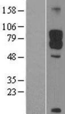 Western Blot: DAB1 Overexpression Lysate (Adult Normal) [NBL1-09709] Left-Empty vector transfected control cell lysate (HEK293 cell lysate); Right -Over-expression Lysate for DAB1.