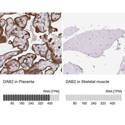 Immunohistochemistry-Paraffin DAB2 Antibody