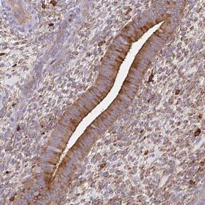 Immunohistochemistry-Paraffin: DAB2 Antibody [NBP2-33915] - Staining of human endometrium shows moderate membranous and cytoplasmic positivity in glandular cells.