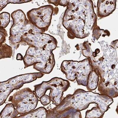 Immunohistochemistry-Paraffin: DAB2 Antibody [NBP2-33915] - Staining of human placenta shows strong membranous and cytoplasmic positivity in trophoblastic cells.