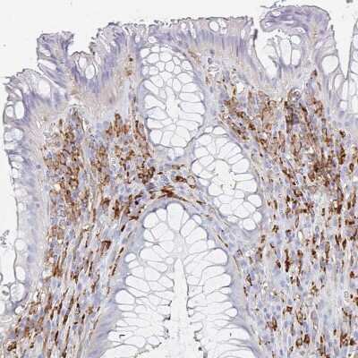 Immunohistochemistry-Paraffin: DAB2 Antibody [NBP2-33915] - Staining of human rectum shows strong cytoplasmic positivity in lymphoid cells.