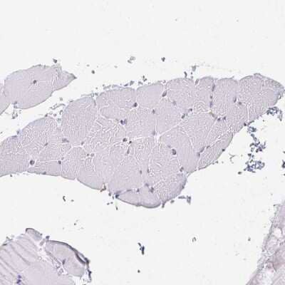 Immunohistochemistry-Paraffin: DAB2 Antibody [NBP2-33915] - Staining of human skeletal muscle shows no positivity in myocytes as expected.