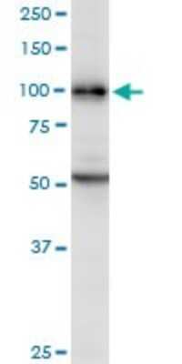 Western Blot: DAB2 Antibody [H00001601-B01P] - Analysis of DAB2 expression in HeLa.
