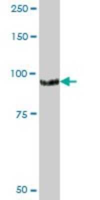 Western Blot: DAB2 Antibody [H00001601-B01P] - Analysis of DAB2 expression in human liver.