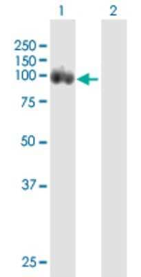 Western Blot: DAB2 Antibody [H00001601-B01P] - Analysis of DAB2 expression in transfected 293T cell line by DAB2 polyclonal antibody.  Lane 1: DAB2 transfected lysate(84.7 KDa). Lane 2: Non-transfected lysate.