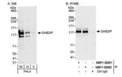 Western Blot: DAB2IP Antibody [NBP1-30082] - Whole cell lysate from HeLa cells. DAB2IP was also immunoprecipitated by rabbit anti-DAB2IP antibody NBP1-30081. For blotting IPed DAB2IP, the ReliaBLOT (Trademark)  Reagents and Procedures were used.