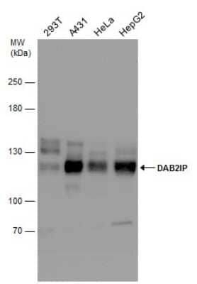 Western Blot: DAB2IP Antibody [NBP3-13027] - Various whole cell extracts (30 ug) were separated by 5% SDS-PAGE, and the membrane was blotted with DAB2IP antibody (NBP3-13027) diluted at 1:1000.