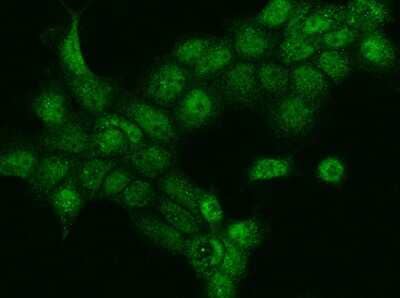 Immunocytochemistry/ Immunofluorescence DACH1 Antibody