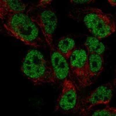 Immunocytochemistry/Immunofluorescence: DACH1 Antibody [NBP3-17784] - Staining of human cell line HAP1 shows localization to nucleoplasm.