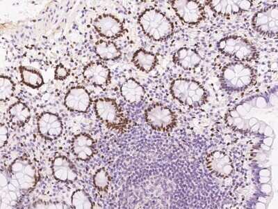 Immunohistochemistry: DACH1 Antibody [NBP3-06643] - Immunochemical staining of human DACH1 in human small intestine with NBP3-06643 at 1:500 dilution, formalin-fixed paraffin embedded sections.