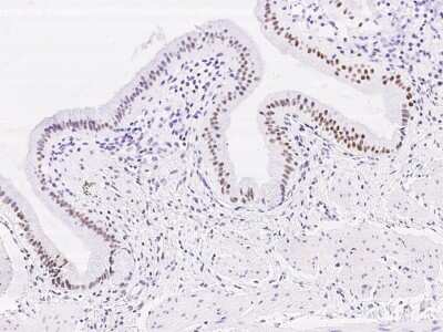 Immunohistochemistry: DACH1 Antibody [NBP3-06643] - Immunochemical staining of human DACH1 in human gallbladder with NBP3-06643 at 1:500 dilution, formalin-fixed paraffin embedded sections.