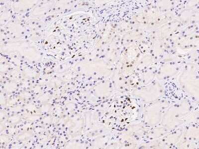 Immunohistochemistry: DACH1 Antibody [NBP3-06643] - Immunohistochemical staining of human DACH1 in human kidney with NBP3-06643 at 1:500 dilution, formalin-fixed paraffin embedded sections.