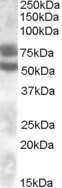 Western Blot: DACH1 Antibody [NBP1-00136] - Analysis of DACH1 in Human Kidney lysate (35ug protein in RIPA buffer) using this antibody at 0.1 ug/mL. Primary incubation was 1 hour. Detected by chemiluminescence.