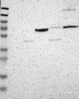 Western Blot: DACH1 Antibody [NBP3-17784] - Lane 1: Marker [kDa] 230, 130, 95, 72, 56, 36, 28, 17, 11;   Lane 2: RT4;   Lane 3: U-251 MG;   Lane 4: Human Plasma;   Lane 5: Liver;   Lane 6: Tonsil