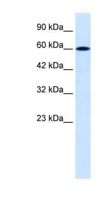 Western Blot: DACH2 Antibody [NBP1-80001] - Jurkat cell lysate, concentration 0.2-1 ug/ml.