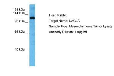 Western Blot: DAGLA Antibody [NBP2-84760] - Host: Rabbit. Target Name: DAGLA. Sample Tissue: Human Mesenchymoma Tumor lysates. Antibody Dilution: 1ug/ml