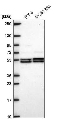 Western Blot DAGLB Antibody - BSA Free