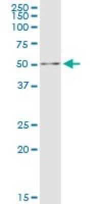 Western Blot: DALRD3 Antibody [H00055152-B01P] - Analysis of DALRD3 expression in Jurkat.