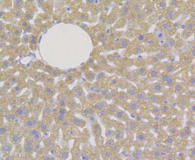 Immunohistochemistry: DAP Kinase 1 Antibody (12B2) [NBP2-76835] - Immunohistochemical analysis of paraffin-embedded mouse liver tissue using anti-DAP Kinase 1 antibody. The section was pre-treated using heat mediated antigen retrieval with Tris-EDTA buffer (pH 8.0-8.4) for 20 minutes.The tissues were blocked in 5% BSA for 30 minutes at room temperature, washed with ddH2O and PBS, and then probed with the antibody at 1/50 dilution, for 30 minutes at room temperature and detected using an HRP conjugated compact polymer system. DAB was used as the chrogen. Counter stained with hematoxylin and mounted with DPX.