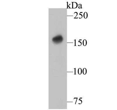 Western Blot: DAP Kinase 1 Antibody (12B2) [NBP2-76835] - Western blot analysis of DAP Kinase 1 on rat brain tissue lysate. Proteins were transferred to a PVDF membrane and blocked with 5% BSA in PBS for 1 hour at room temperature. The primary antibody was used at a 1:500 dilution in 5% BSA at room temperature for 2 hours. Goat Anti-Mouse IgG - HRP Secondary Antibody at 1:5,000 dilution was used for 1 hour at room temperature.