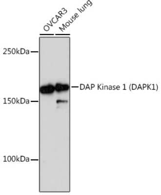 Western Blot: DAP Kinase 1 Antibody (3E10G3) [NBP3-15382] - Western blot analysis of extracts of various cell lines, using DAP Kinase 1 Rabbit mAb (NBP3-15382) at 1:1000 dilution. Secondary antibody: HRP Goat Anti-Rabbit IgG (H+L) at 1:10000 dilution. Lysates/proteins: 25ug per lane. Blocking buffer: 3% nonfat dry milk in TBST. Detection: ECL Basic Kit. Exposure time: 3min.