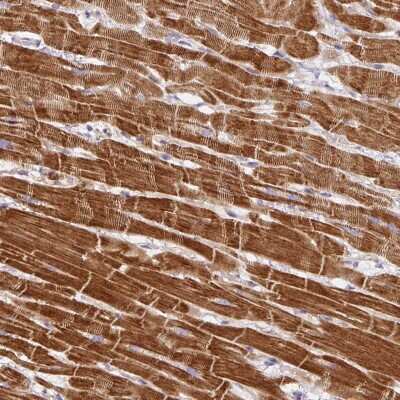 Immunohistochemistry-Paraffin: DAP Kinase 1 Antibody [NBP2-38580] - Staining of human heart muscle shows strong cytoplasmic positivity in myocytes.