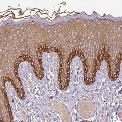 Immunohistochemistry-Paraffin: DAP Kinase 1 Antibody [NBP2-38468] - Staining of human vulva/anal skin shows distinct cytoplasmic positivity in basal layer of epidermis.