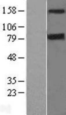 Western Blot: DAP Kinase 1 Overexpression Lysate (Adult Normal) [NBL1-09716] Left-Empty vector transfected control cell lysate (HEK293 cell lysate); Right -Over-expression Lysate for DAP Kinase 1.