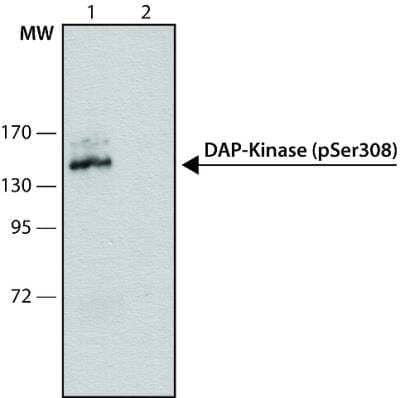 Western Blot: DAP Kinase 1 [p Ser308] Antibody (DKPS308) [NB120-10524] - Whole extract of HEK-293 cells overexpressing human DAP Kinase was separated on SDS-PAGE and probed with 1 ug/mL Monoclonal Anti-phospho-DAP-Kinase (pSer308) Clone: DKPS308. The antibody was developed using Goat Anti-Mouse IgG-Peroxidase and a chemiluminescent substrate.