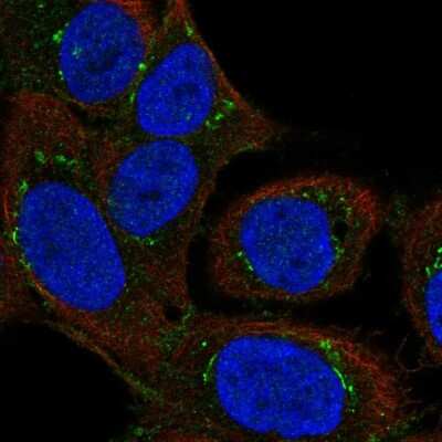 Immunocytochemistry/Immunofluorescence: DAP Kinase 2 Antibody [NBP2-57307] - Staining of human cell line HaCaT shows localization to the Golgi apparatus & vesicles.