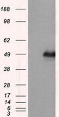 Western Blot: DAP Kinase 2 Antibody (OTI1C5) - Azide and BSA Free [NBP2-71753] - HEK293T cells were transfected with the pCMV6-ENTRY control (Left lane) or pCMV6-ENTRY DAP Kinase 2 (Right lane) cDNA for 48 hrs and lysed. Equivalent amounts of cell lysates (5 ug per lane) were separated by SDS-PAGE and immunoblotted with anti-DAP Kinas