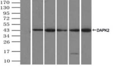 Immunoprecipitation: DAP Kinase 2 Antibody (OTI1C5) [NBP2-02477] - (Negative control: IP without adding anti-DAPK2 antibody.). For each experiment, 500ul of DDK tagged DAPK2 overexpression lysates (at 1:5 dilution with HEK293T lysate), 2ug of anti-DAPK2 antibody and 20ul (0.1mg) of goat anti-mouse conjugated magnetic beads were mixed and incubated overnight. After extensive wash to remove any non-specific binding, the immuno-precipitated products were analyzed with rabbit anti-DDK polyclonal antibody.