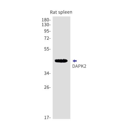 Western Blot: DAP Kinase 2 Antibody (S09-8F2) [NBP3-19618] - Western blot detection of DAP Kinase 2 in Rat spleen cell lysates using NBP3-19618 (1:1000 diluted). Predicted band size: 43kDa. Observed band size: 43kDa.