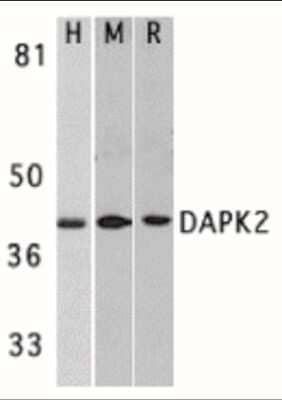 Western Blot: DAP Kinase 2 Antibody [NBP1-77291] - Analysis of DAPK2 in A431 (H), mouse spleen (M), and rat kidney (R) lysates with DAPK2 antibody at 1 ug/mL.