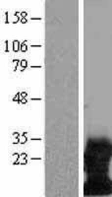 Western Blot: DAP12 Overexpression Lysate (Adult Normal) [NBL1-17483] Left-Empty vector transfected control cell lysate (HEK293 cell lysate); Right -Over-expression Lysate for DAP12.