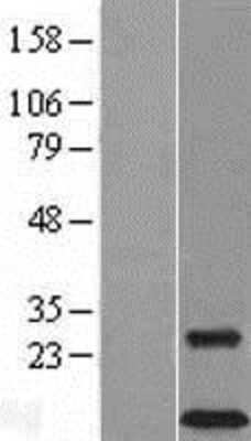 Western Blot: DAP12 Overexpression Lysate (Adult Normal) [NBL1-17484] Left-Empty vector transfected control cell lysate (HEK293 cell lysate); Right -Over-expression Lysate for DAP12.