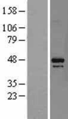 Western Blot: DAP3 Overexpression Lysate (Adult Normal) [NBL1-09715] Left-Empty vector transfected control cell lysate (HEK293 cell lysate); Right -Over-expression Lysate for DAP3.
