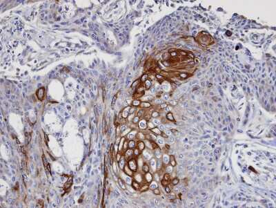 Immunohistochemistry-Paraffin: DAP5 Antibody [NBP1-31469] - Paraffin-embedded Cal27 xenograft, using antibody at 1:100 dilution.