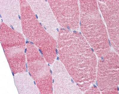 Immunohistochemistry-Paraffin: DAP5 Antibody [NBP1-31469] - Paraffin-embedded Skeletal Muscle, using antibody 10 ug/ml.