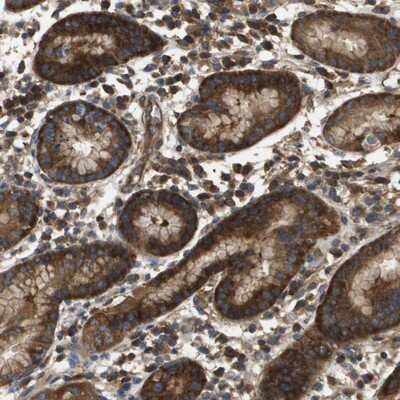 <b>Independent Antibodies Validation. </b>Immunohistochemistry-Paraffin: DAP5 Antibody [NBP1-85310] - Staining of human stomach shows strong cytoplasmic positivity in glandular cells.